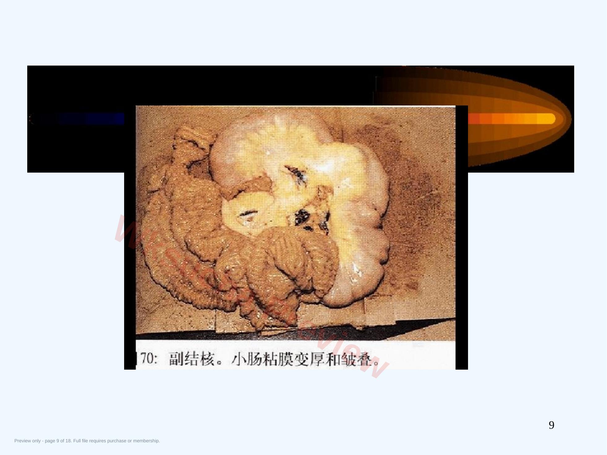 预览第 9 页