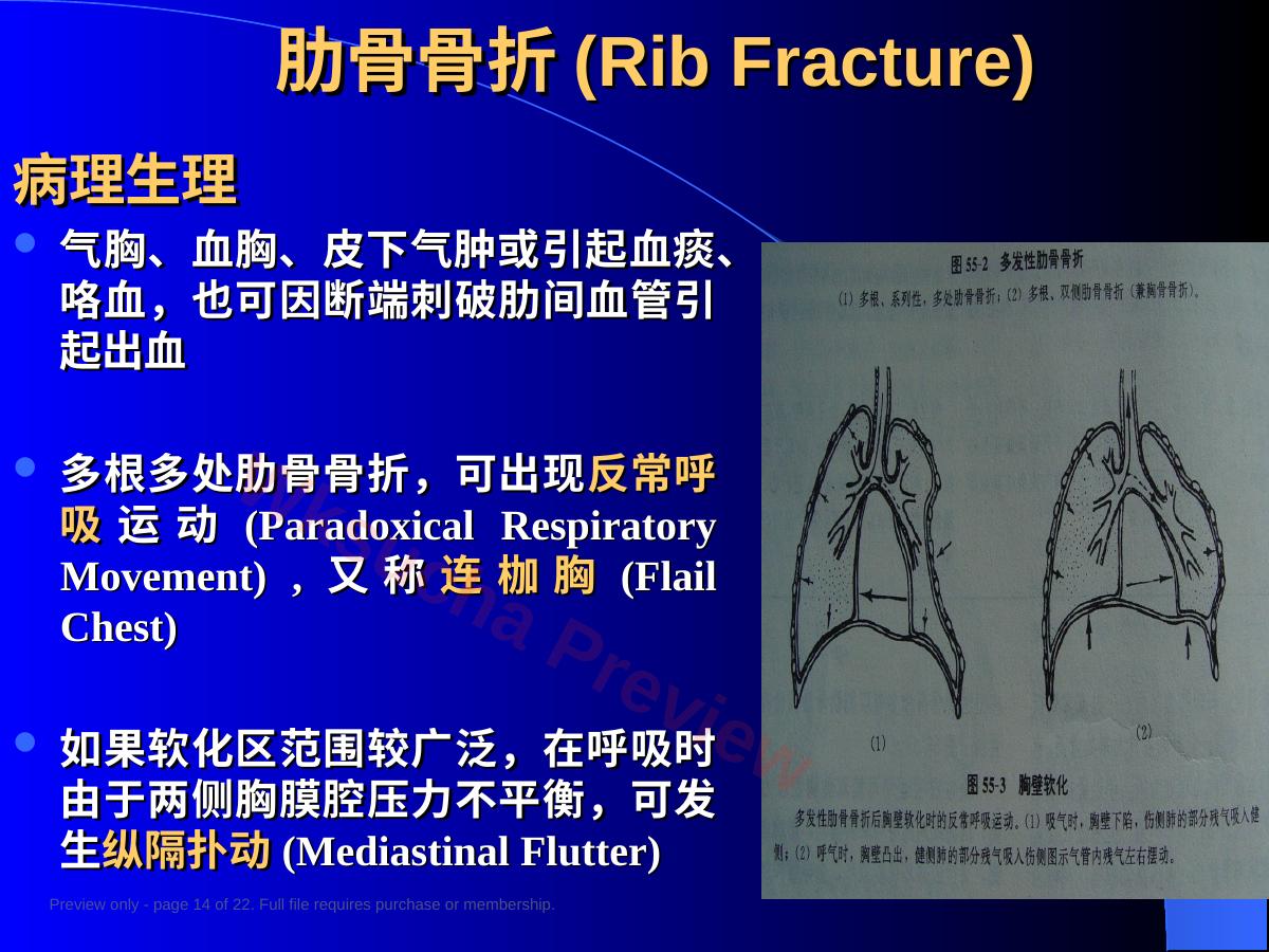 预览第 14 页