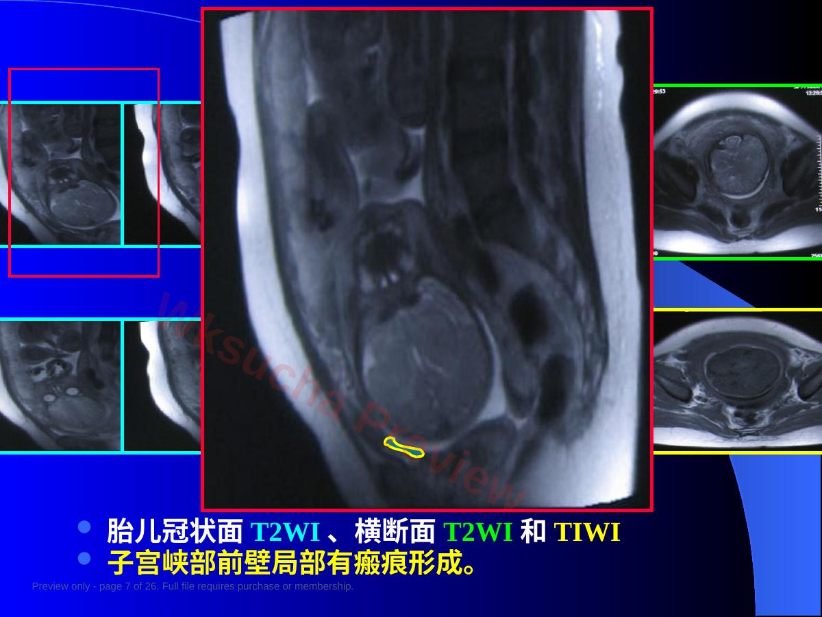 预览第 7 页
