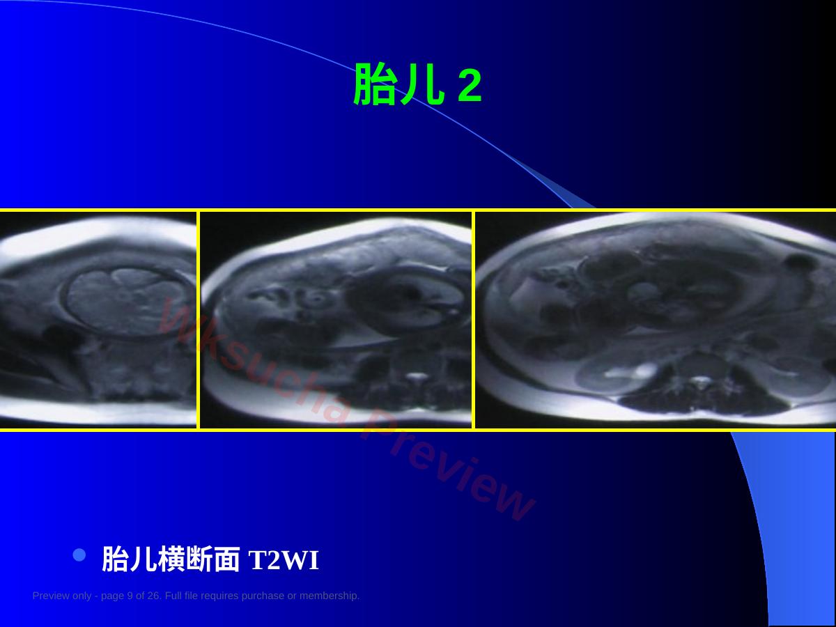 预览第 9 页
