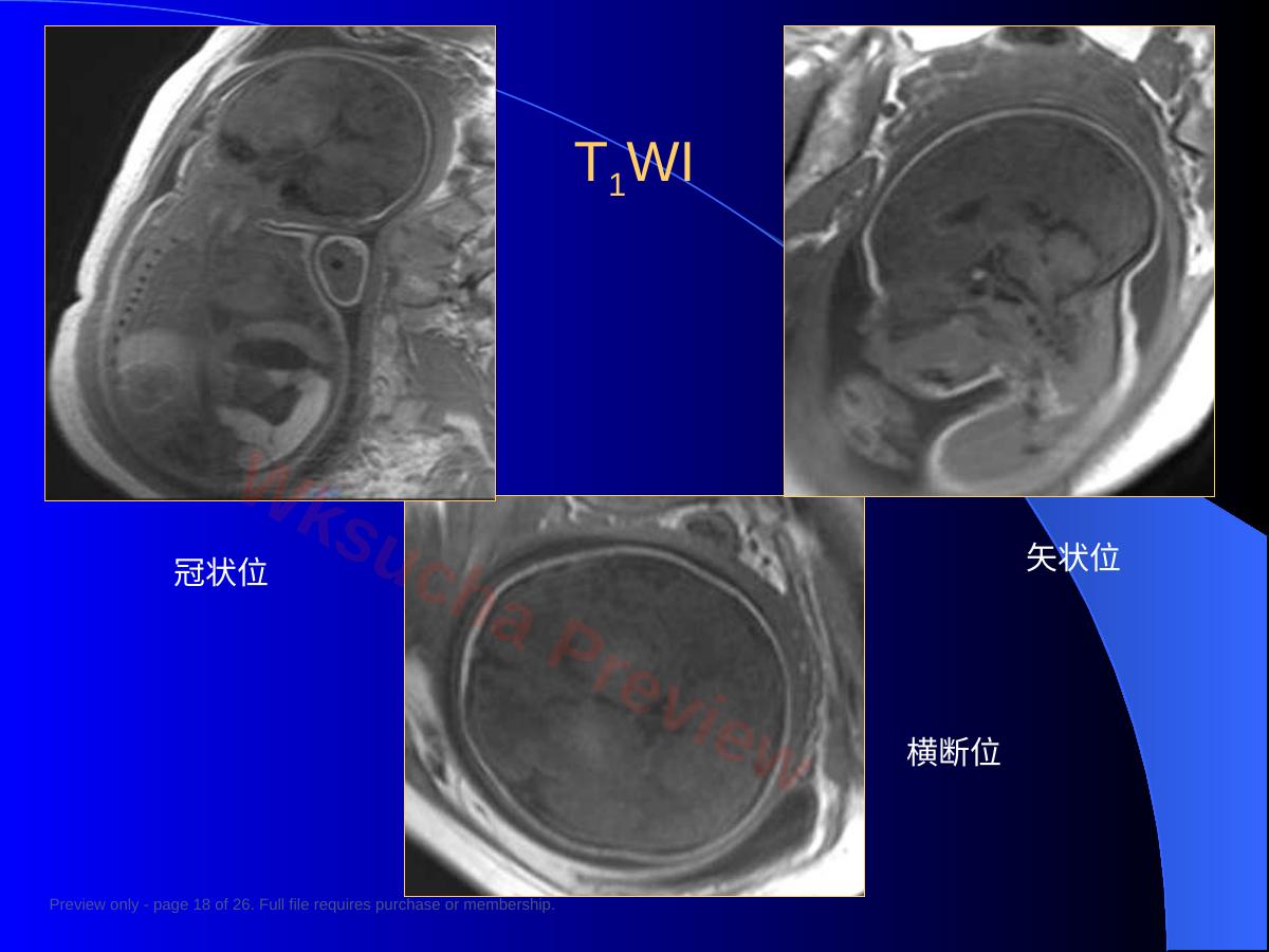 预览第 18 页