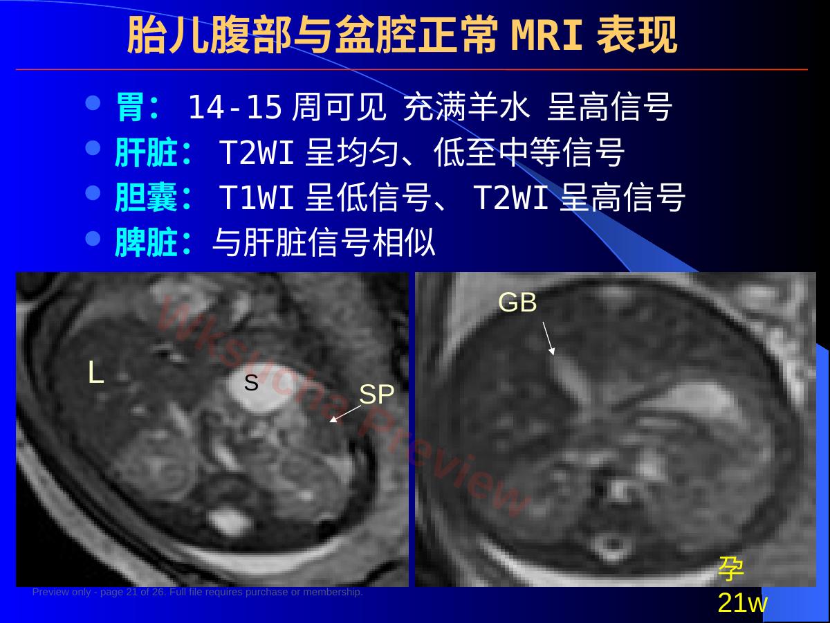 预览第 21 页