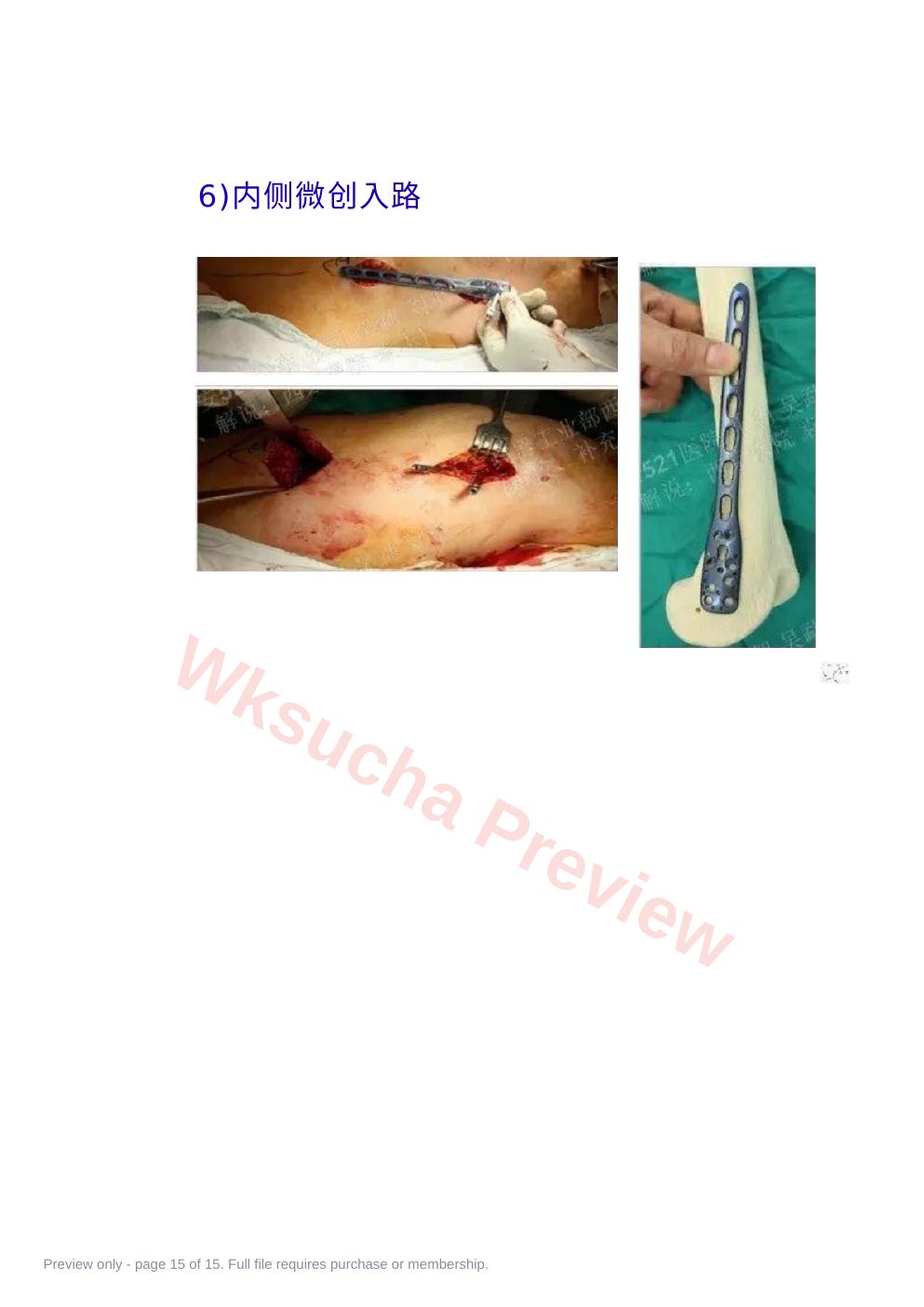 预览第 15 页