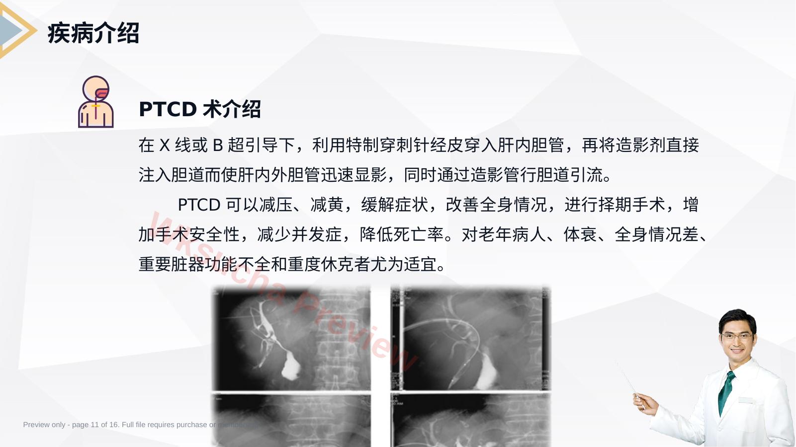 预览第 11 页