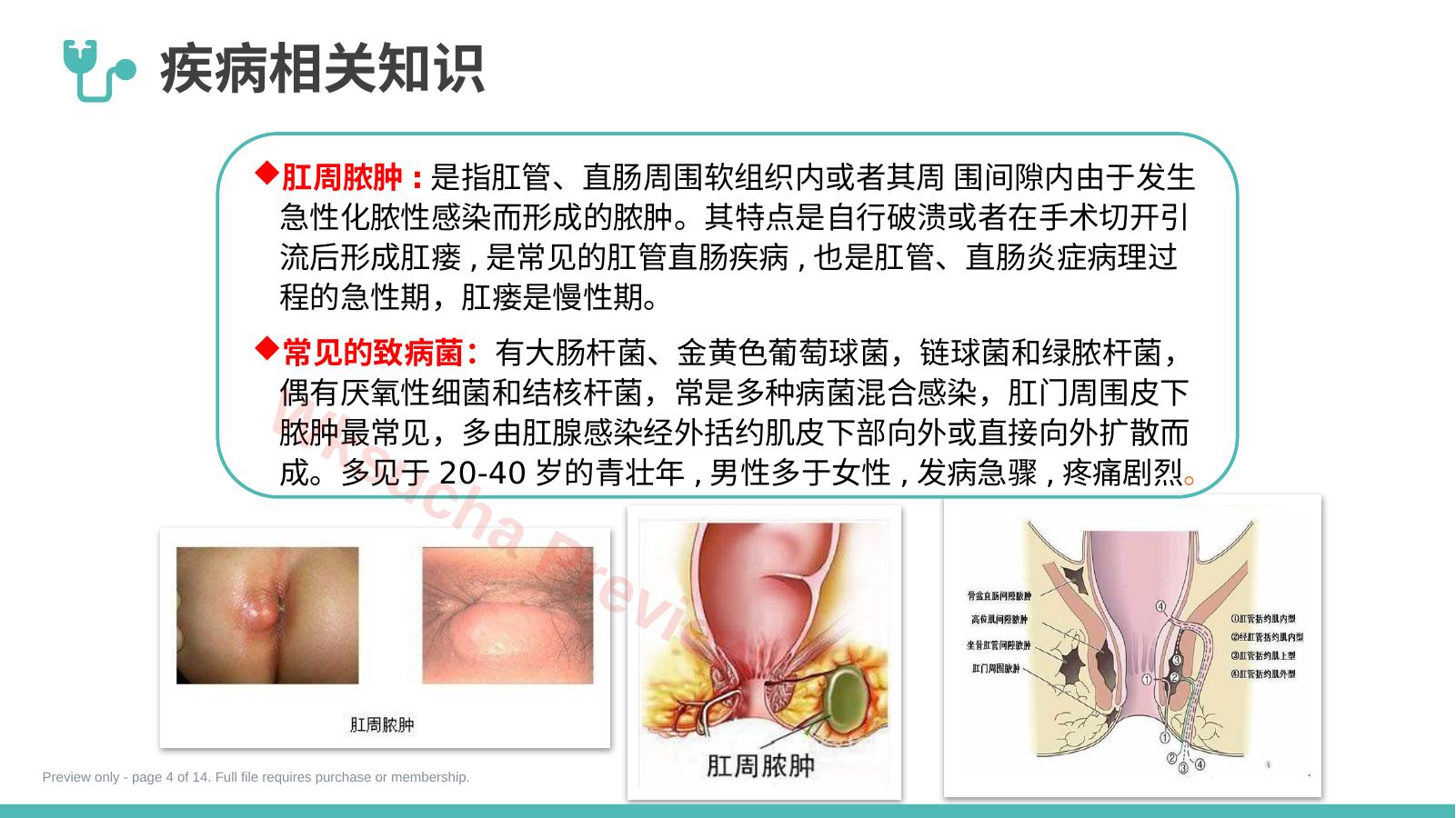预览第 4 页