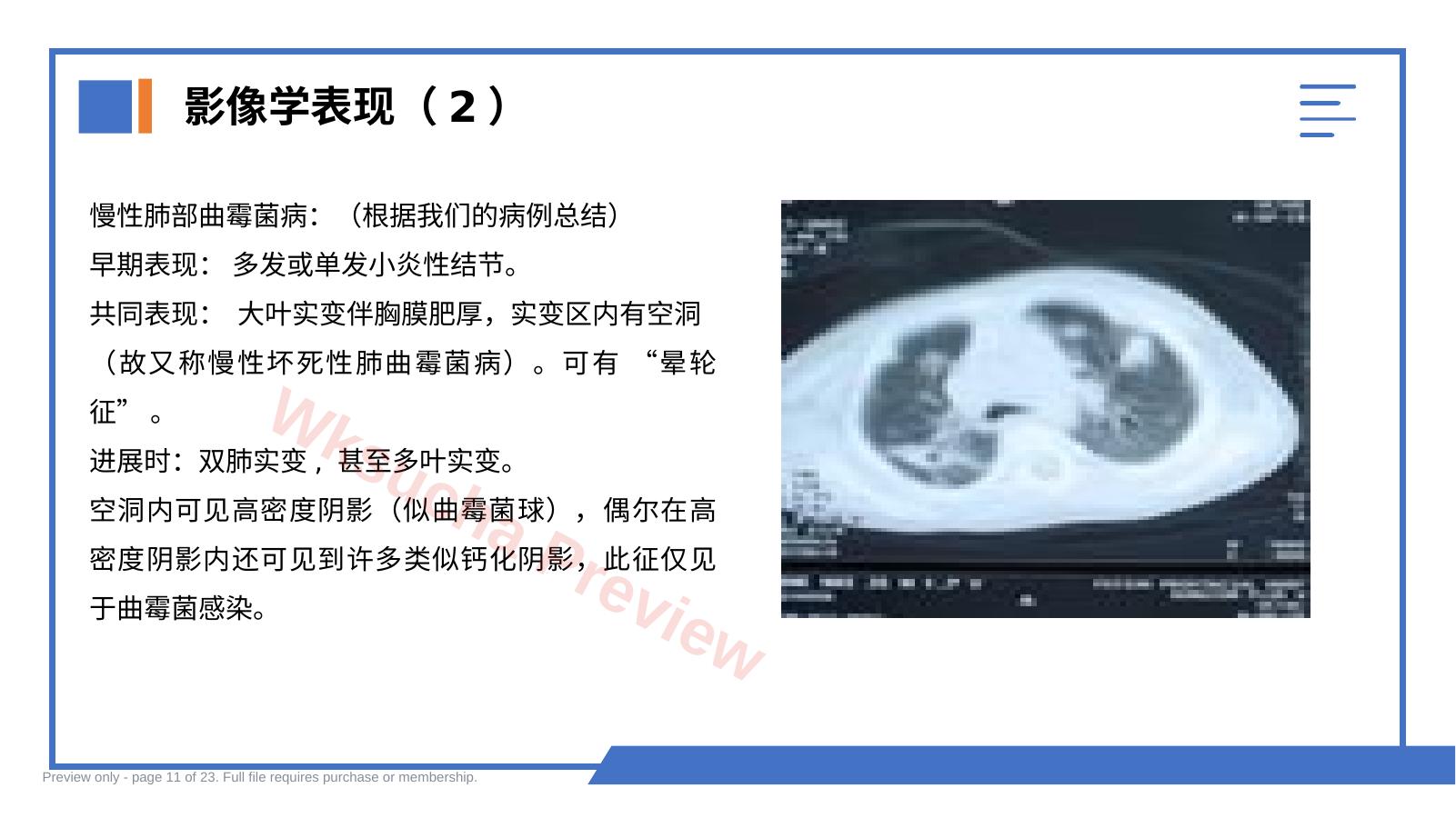 预览第 11 页