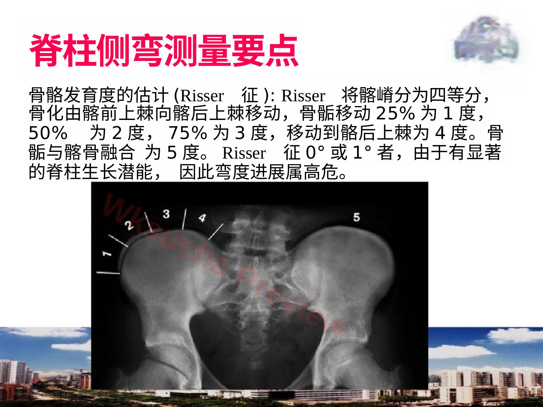 预览第 17 页