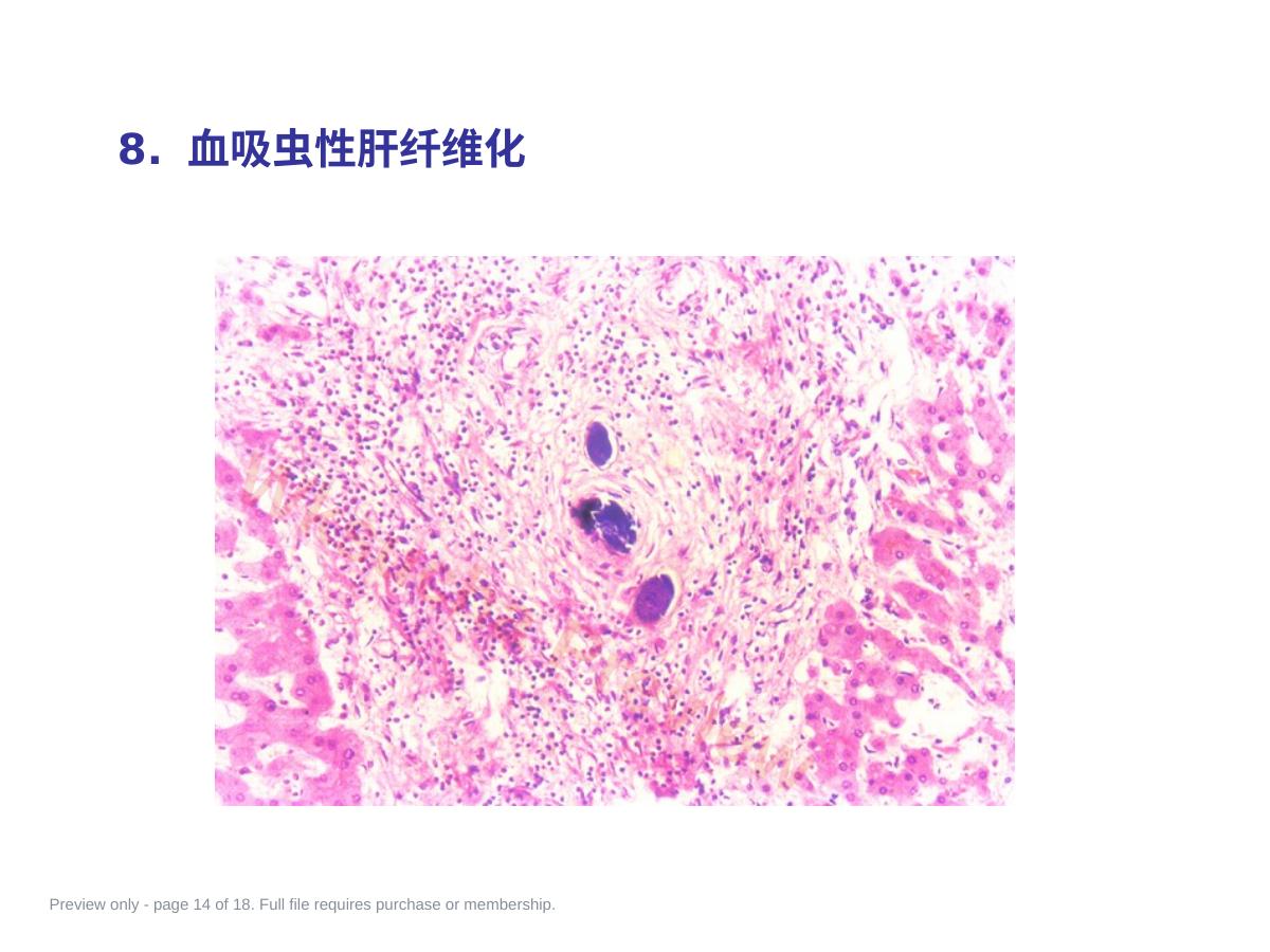 预览第 14 页