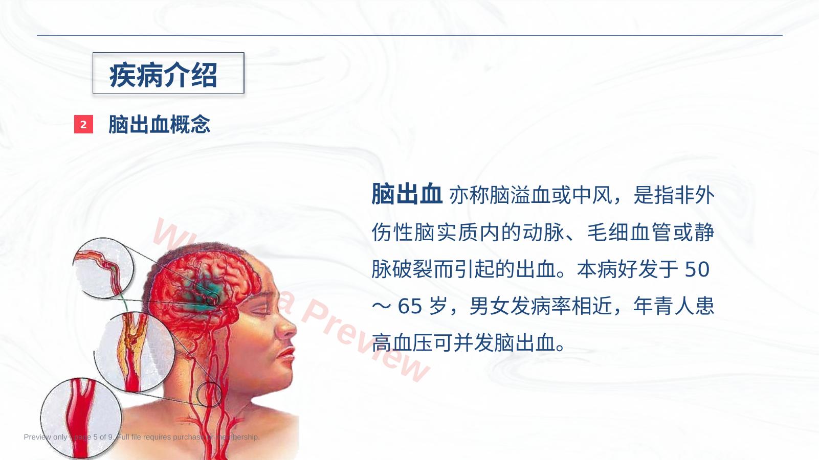预览第 5 页