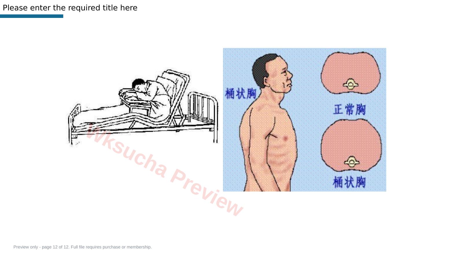 预览第 12 页