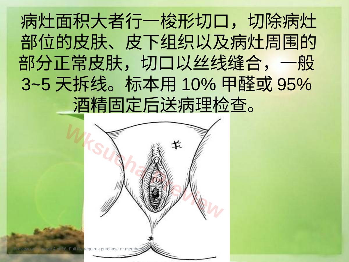预览第 4 页