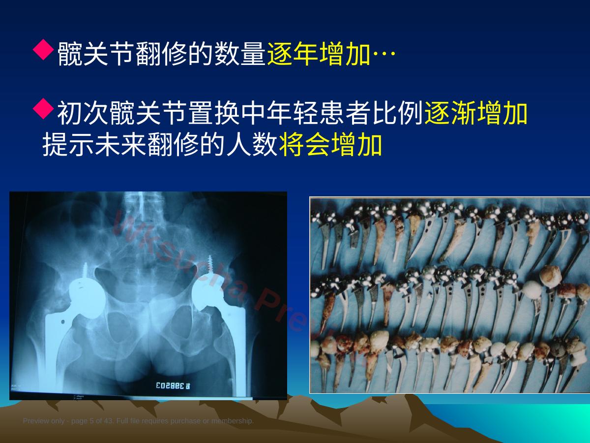 预览第 5 页