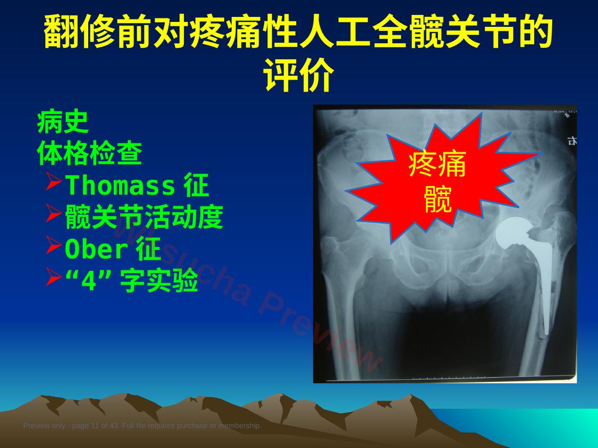 预览第 11 页