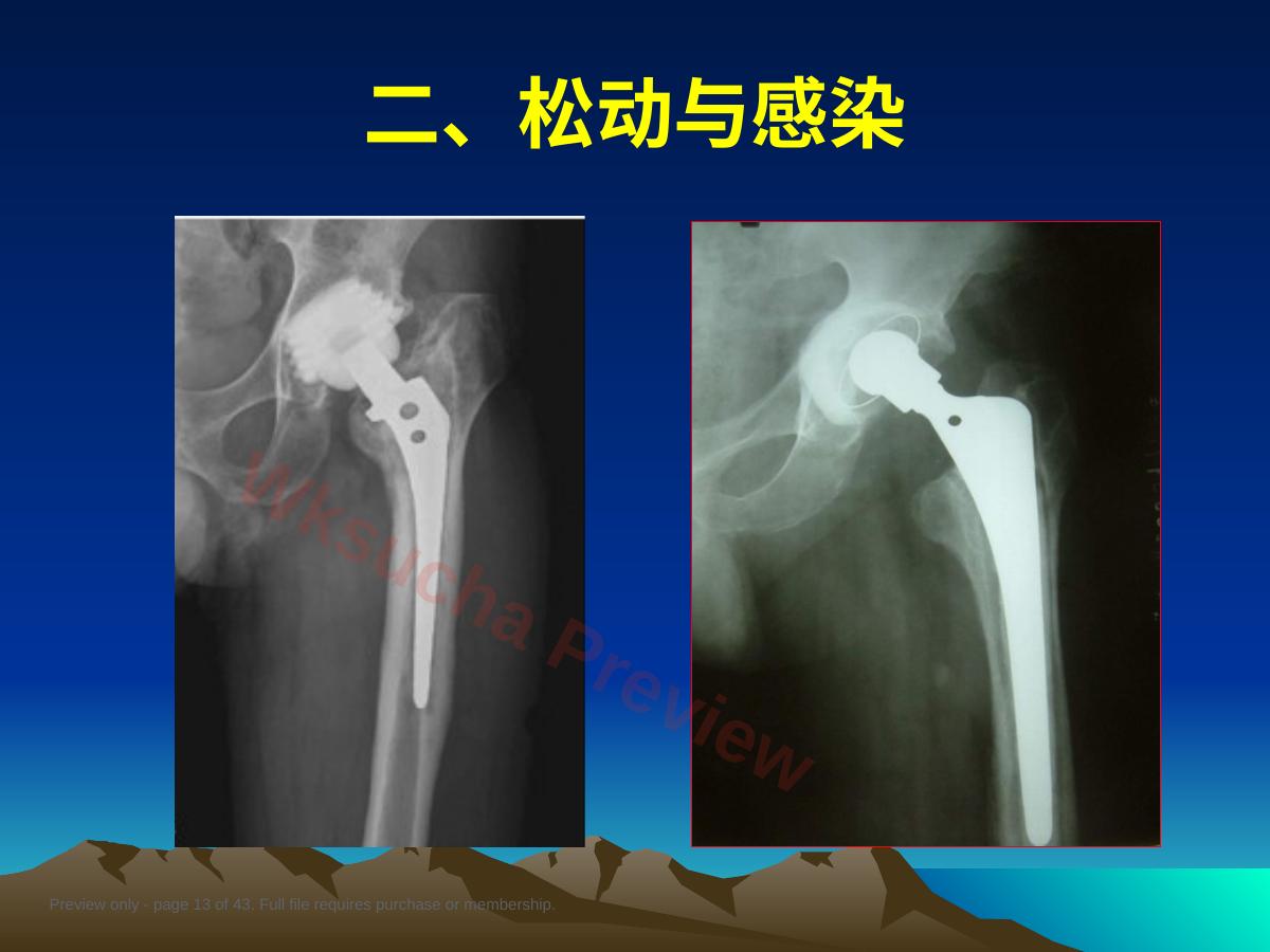 预览第 13 页
