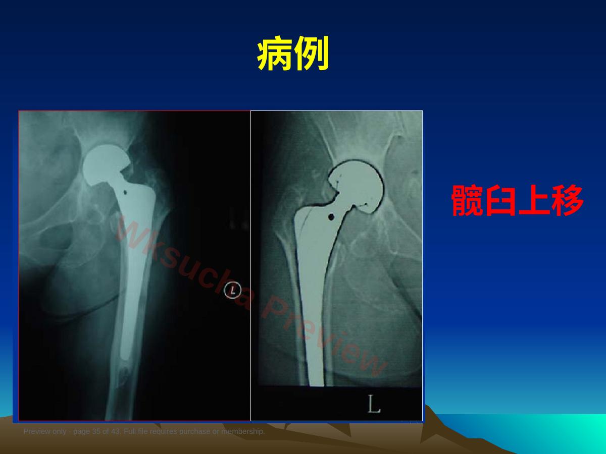 预览第 35 页