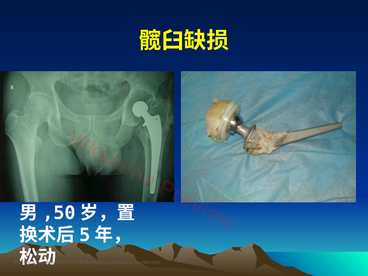预览第 43 页
