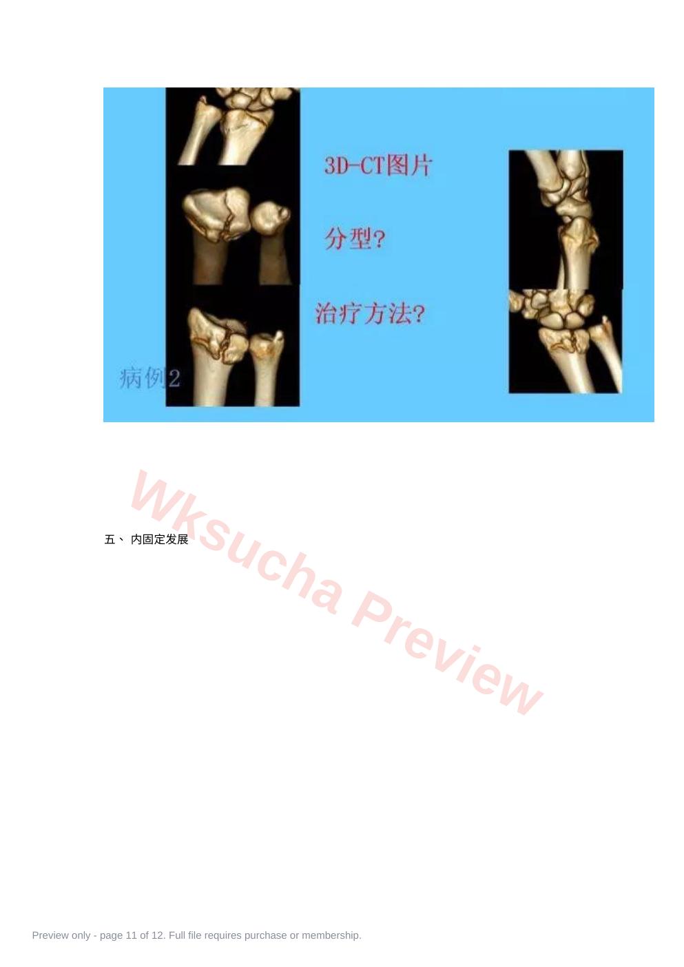 预览第 11 页