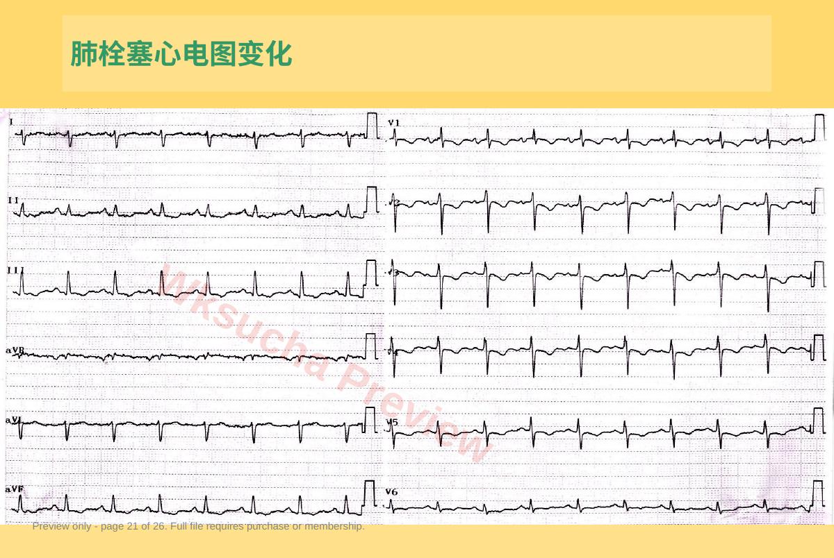 预览第 21 页