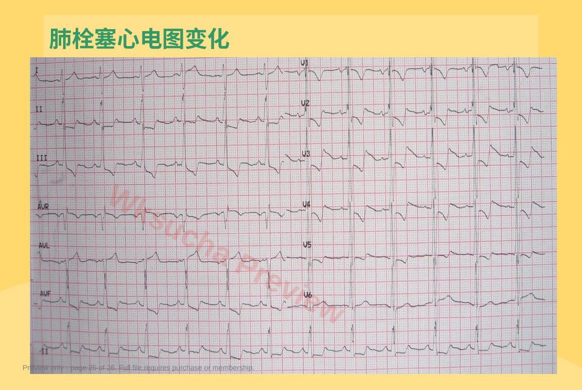 预览第 25 页