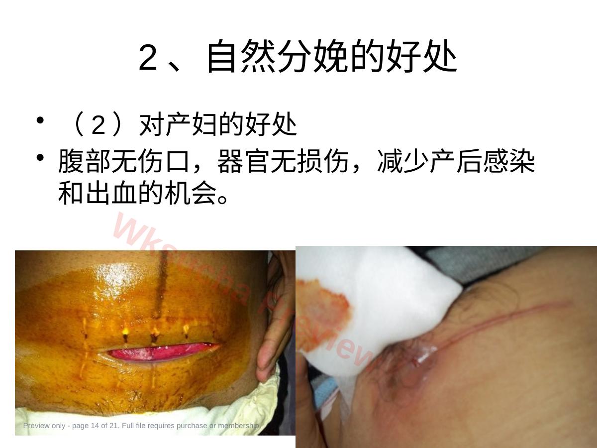 预览第 14 页