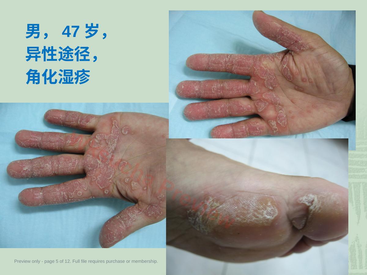 预览第 5 页