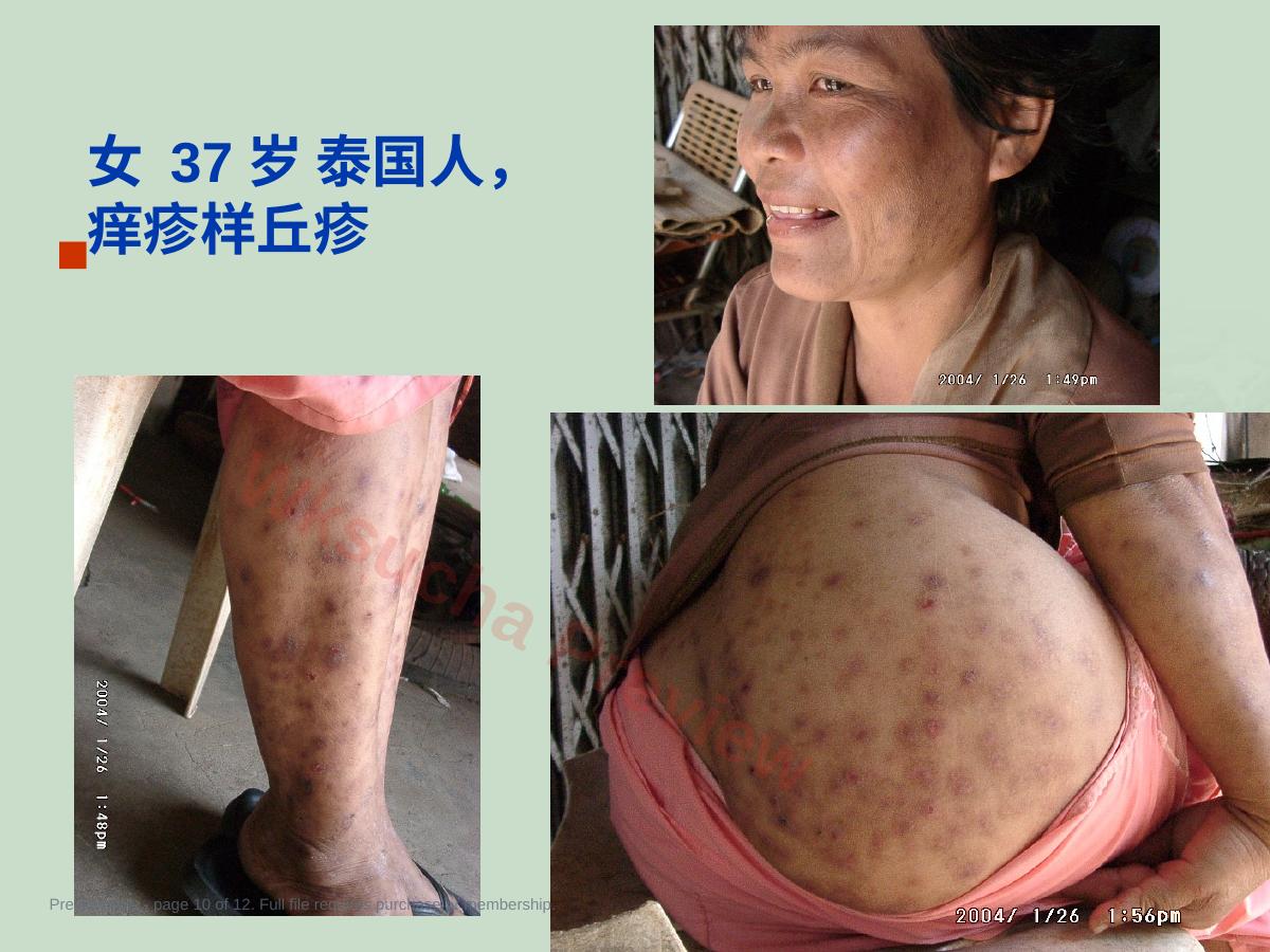 预览第 10 页