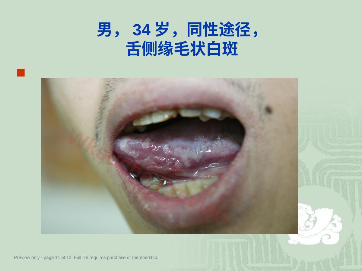 预览第 11 页