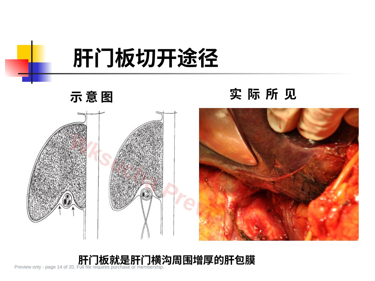 预览第 14 页