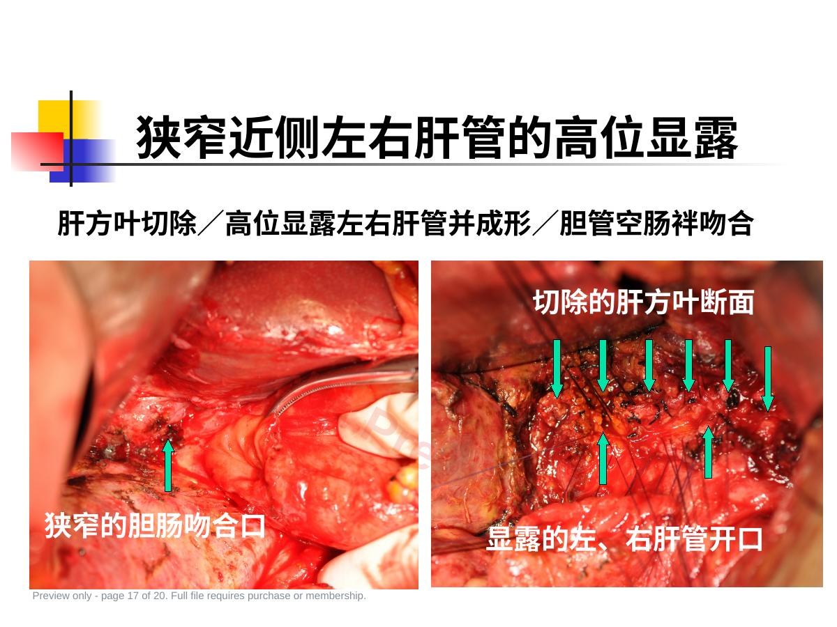 预览第 17 页