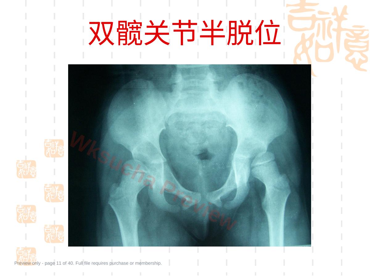 预览第 11 页