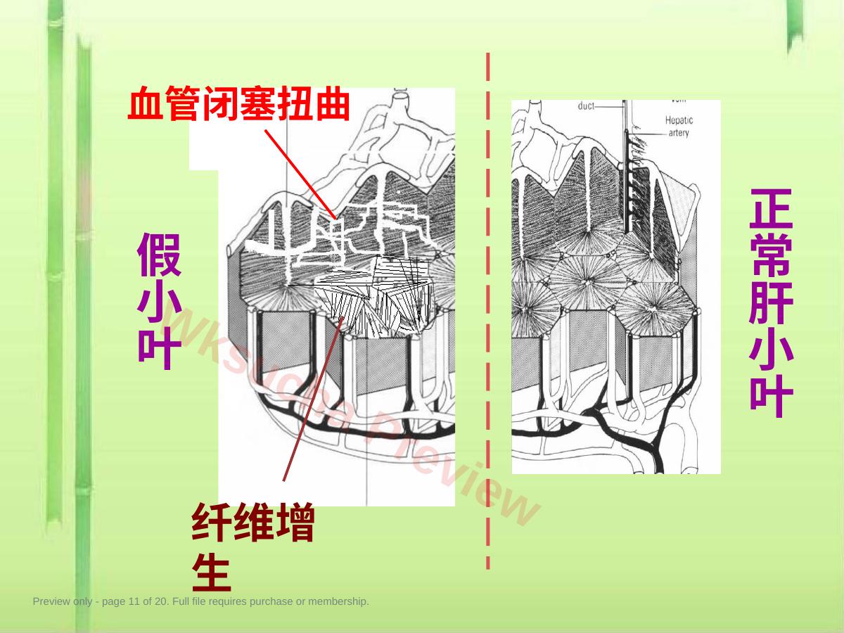 预览第 11 页