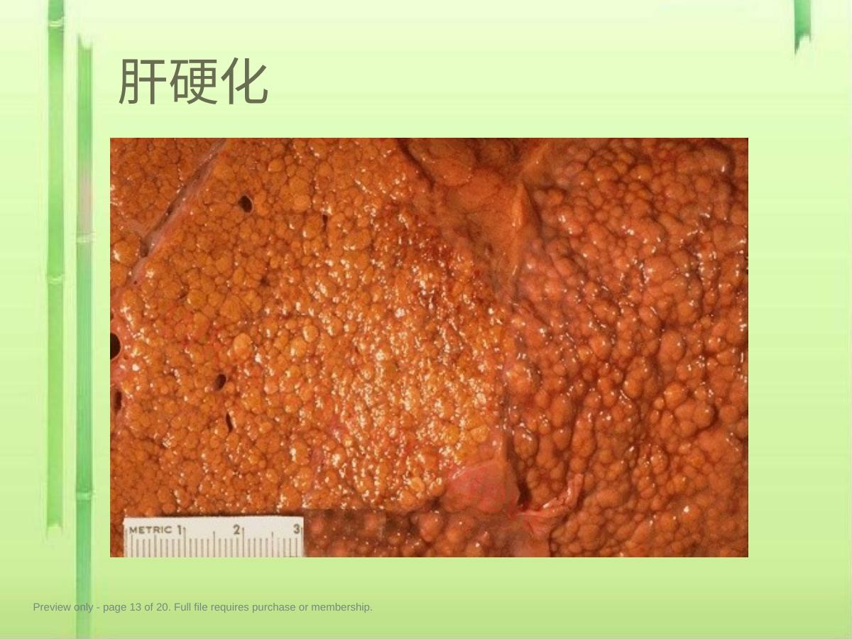 预览第 13 页