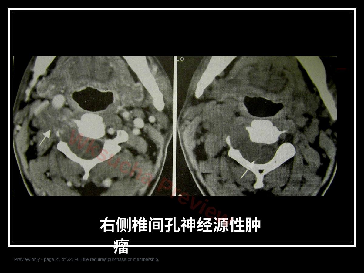 预览第 21 页