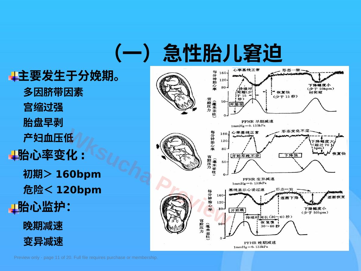 预览第 11 页