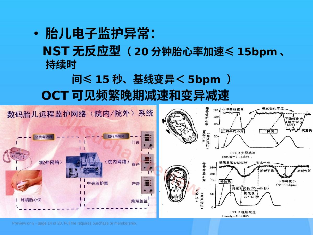 预览第 14 页
