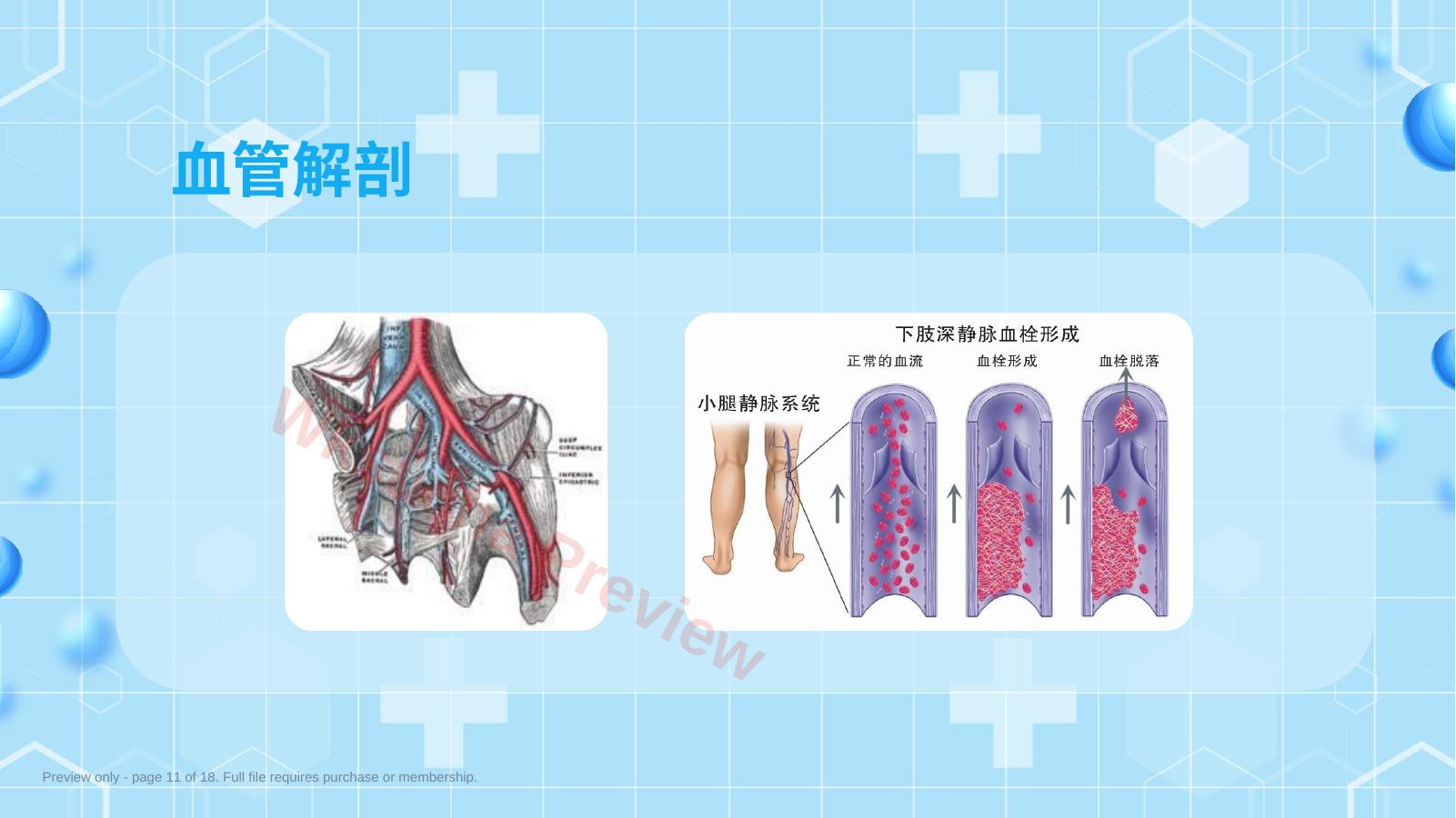 预览第 11 页