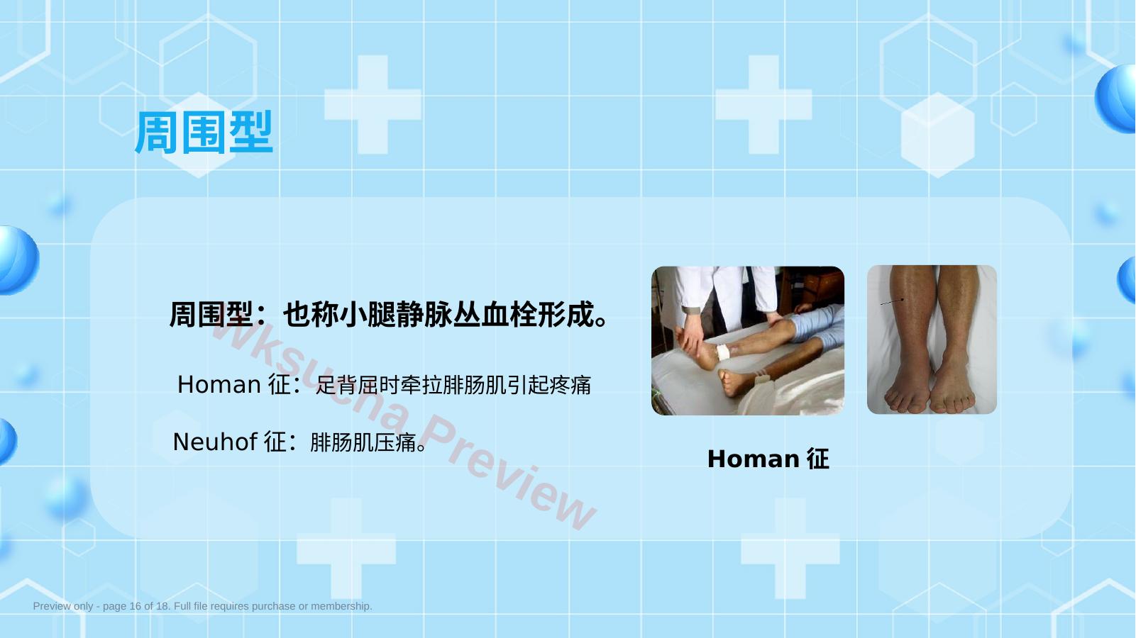 预览第 16 页
