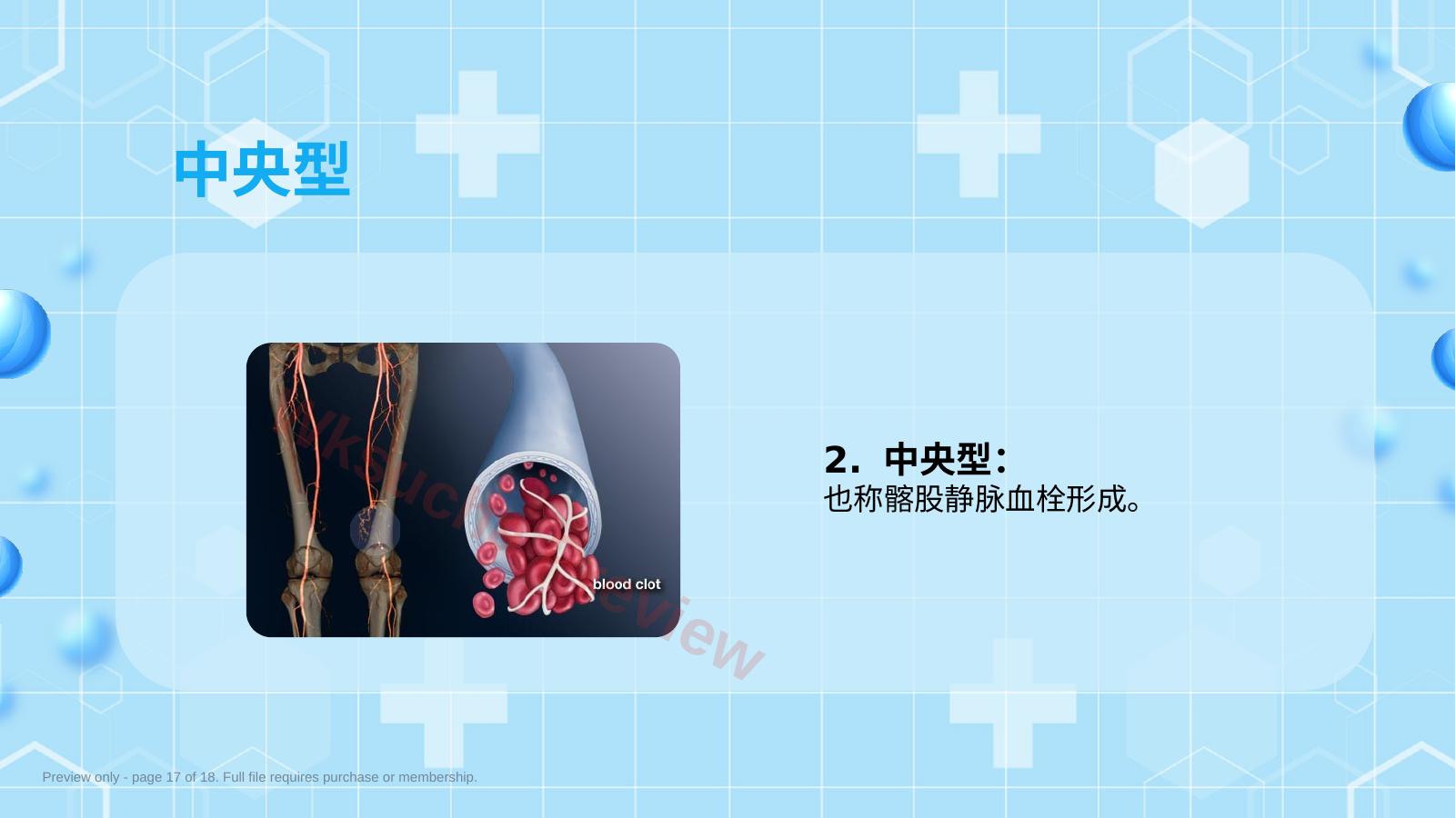预览第 17 页