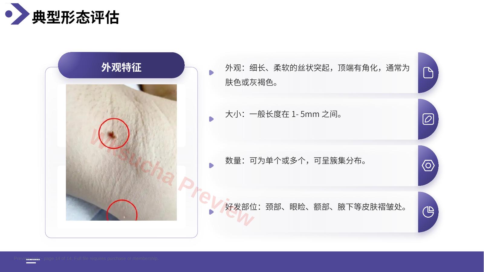 预览第 14 页