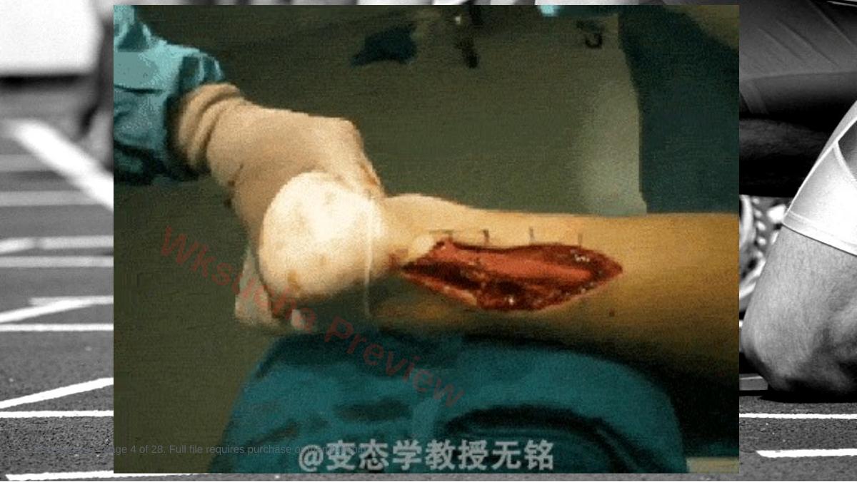 预览第 4 页