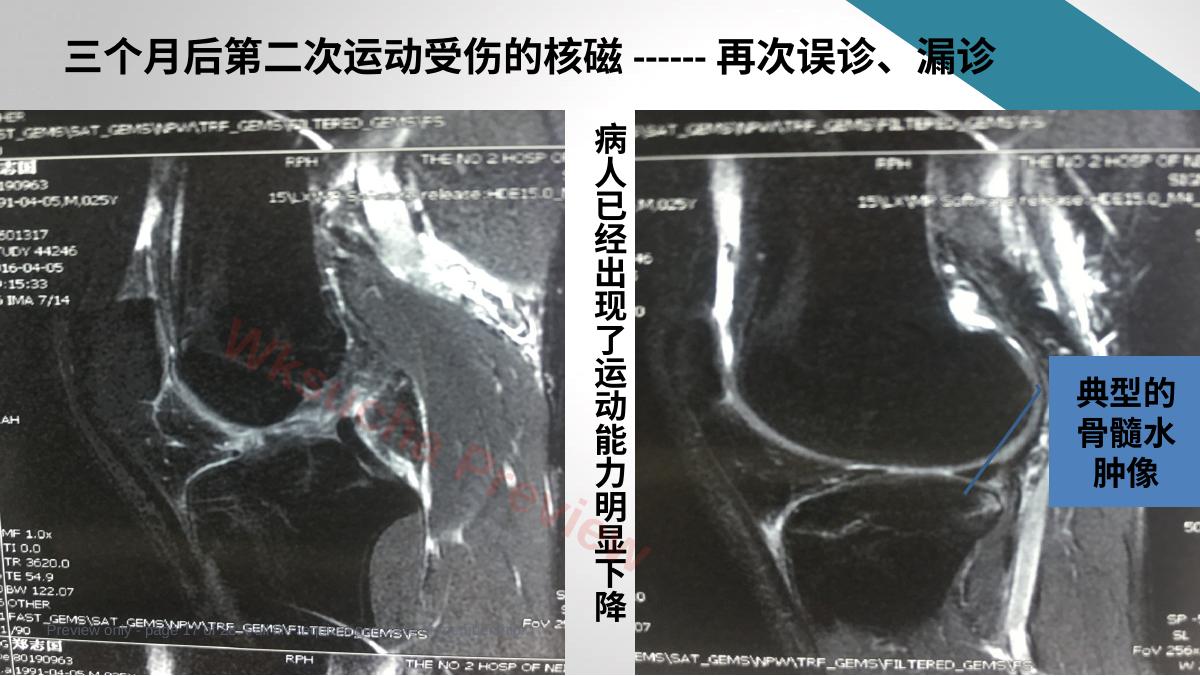 预览第 17 页