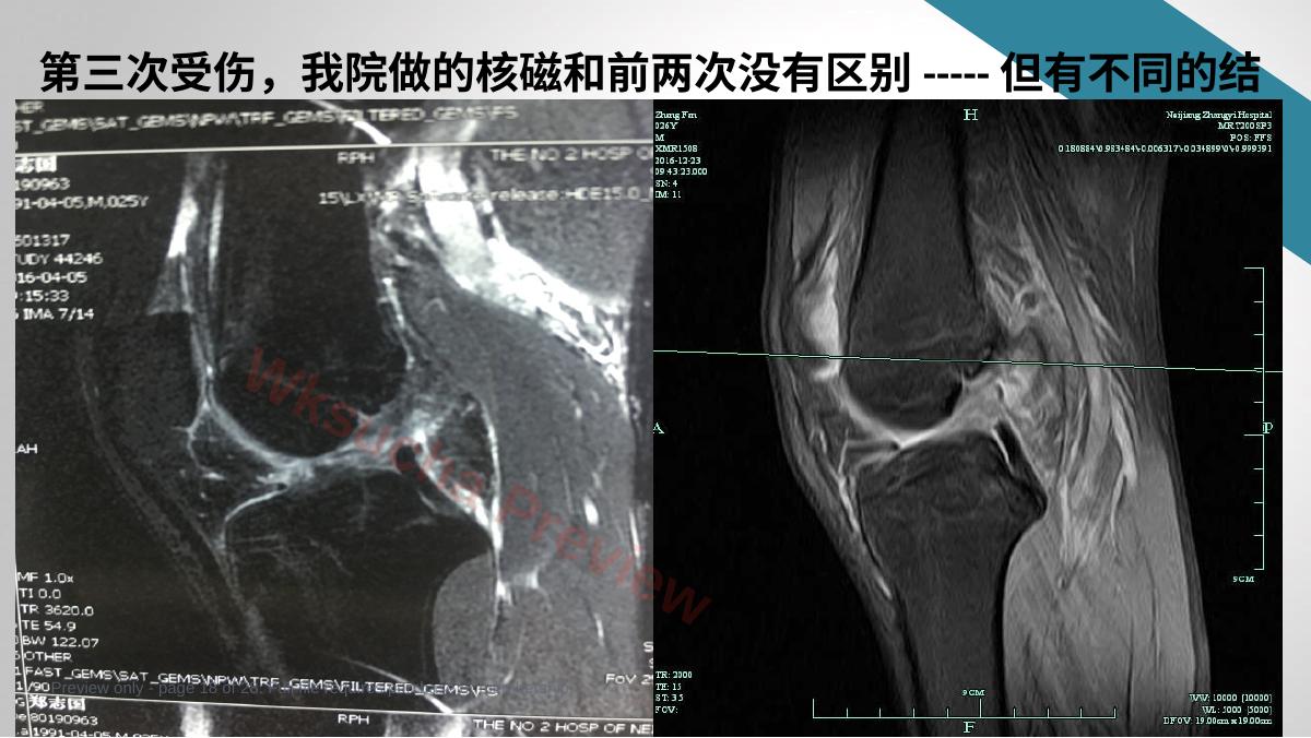 预览第 18 页