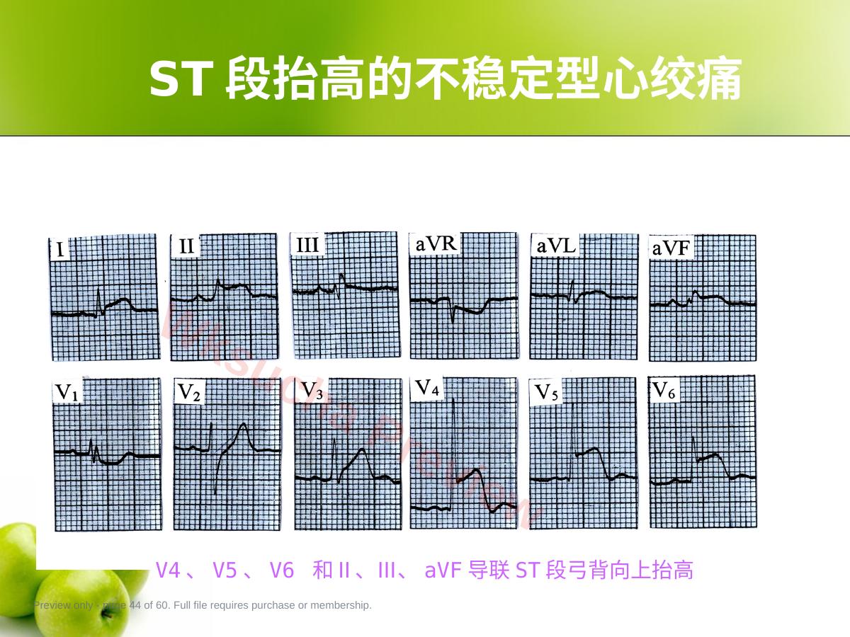 预览第 44 页