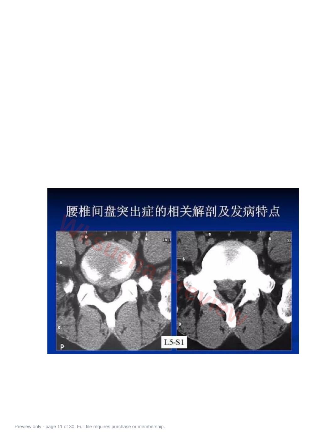 预览第 11 页