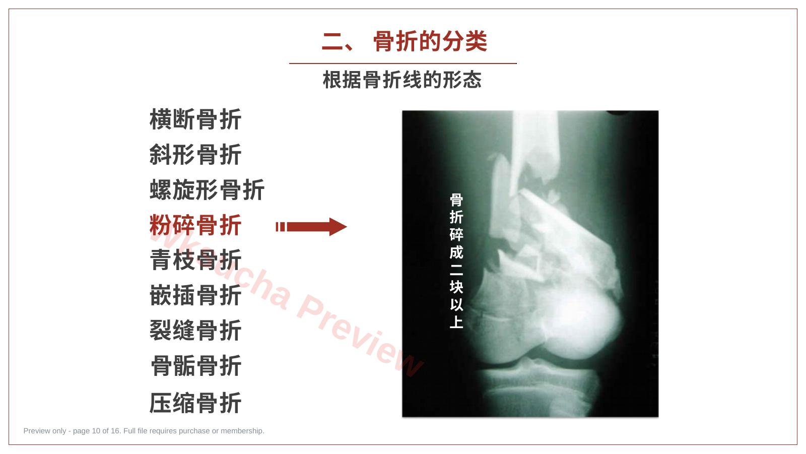 预览第 10 页
