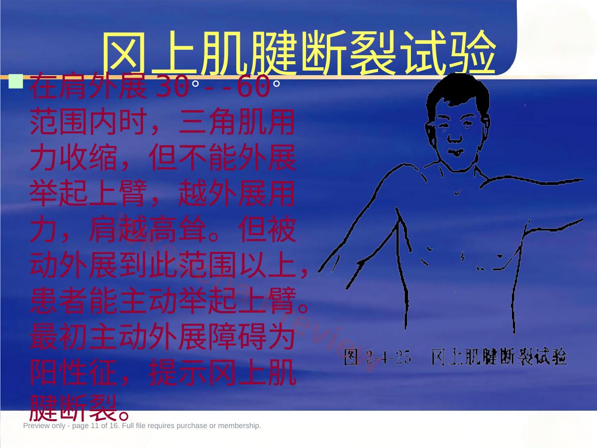 预览第 11 页
