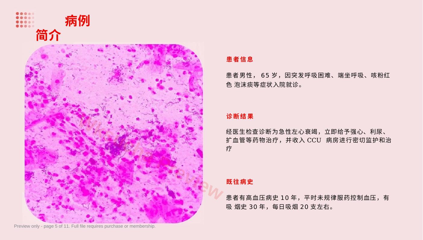 预览第 5 页