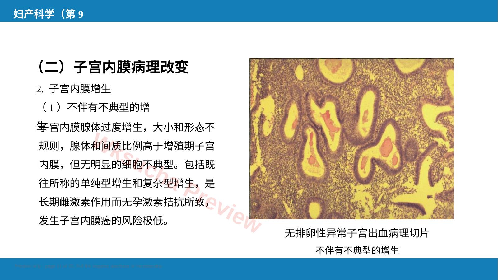 预览第 11 页