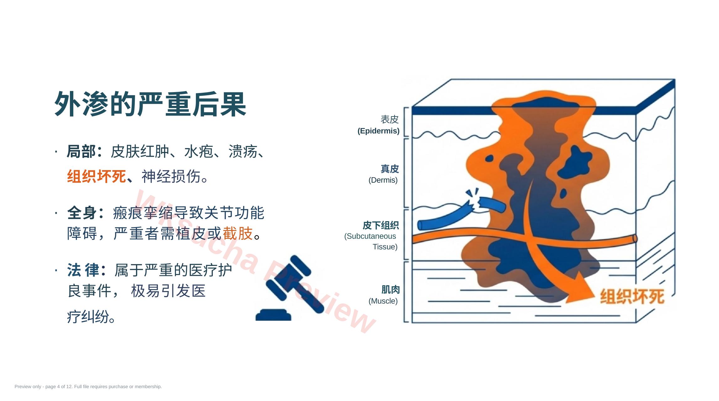 预览第 4 页