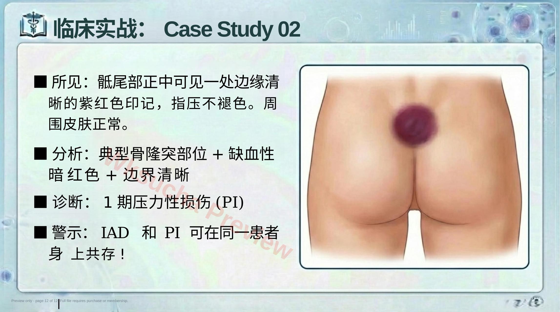 预览第 12 页